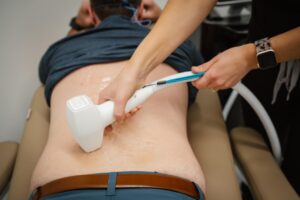 Laser Hair Removal